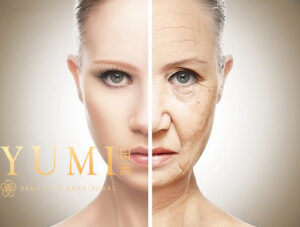 Khách hàng cảm thấy vô cùng hài lòng khi trải nghiệm liệu trình trẻ hóa da Hifu tại Yumi Beauty