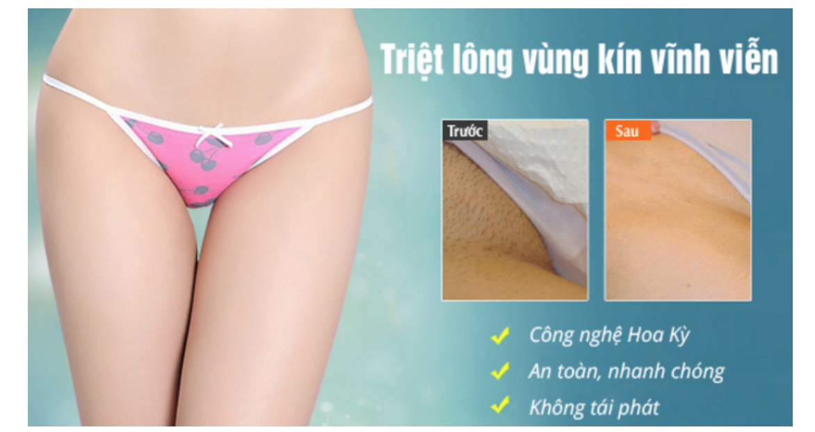 triệt lông bikini